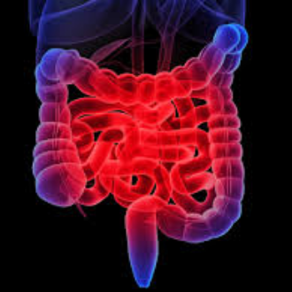 Inflamatory Bowel Disease